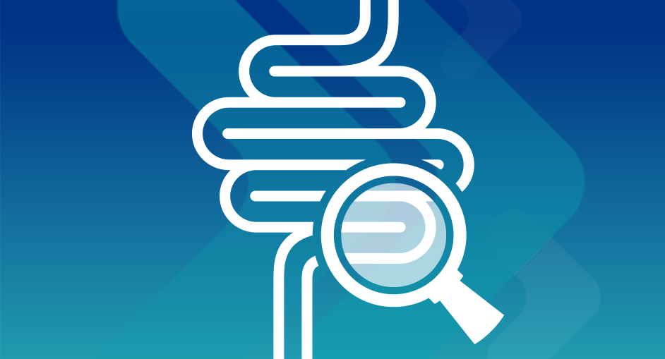 Colon Cancer: Preventable, Treatable and Beatable