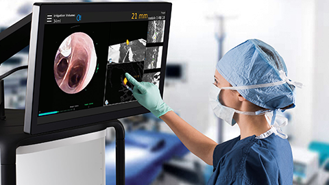 physician viewing biopsy on monarch bronchoscopy touch screen monitor