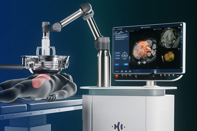Edison Histotripsy System for liver tumors