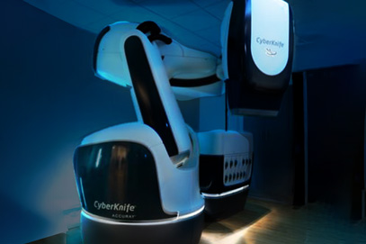 Cyberknife