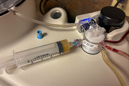 Concentrated platelets being drawn into syringe to be used for injections