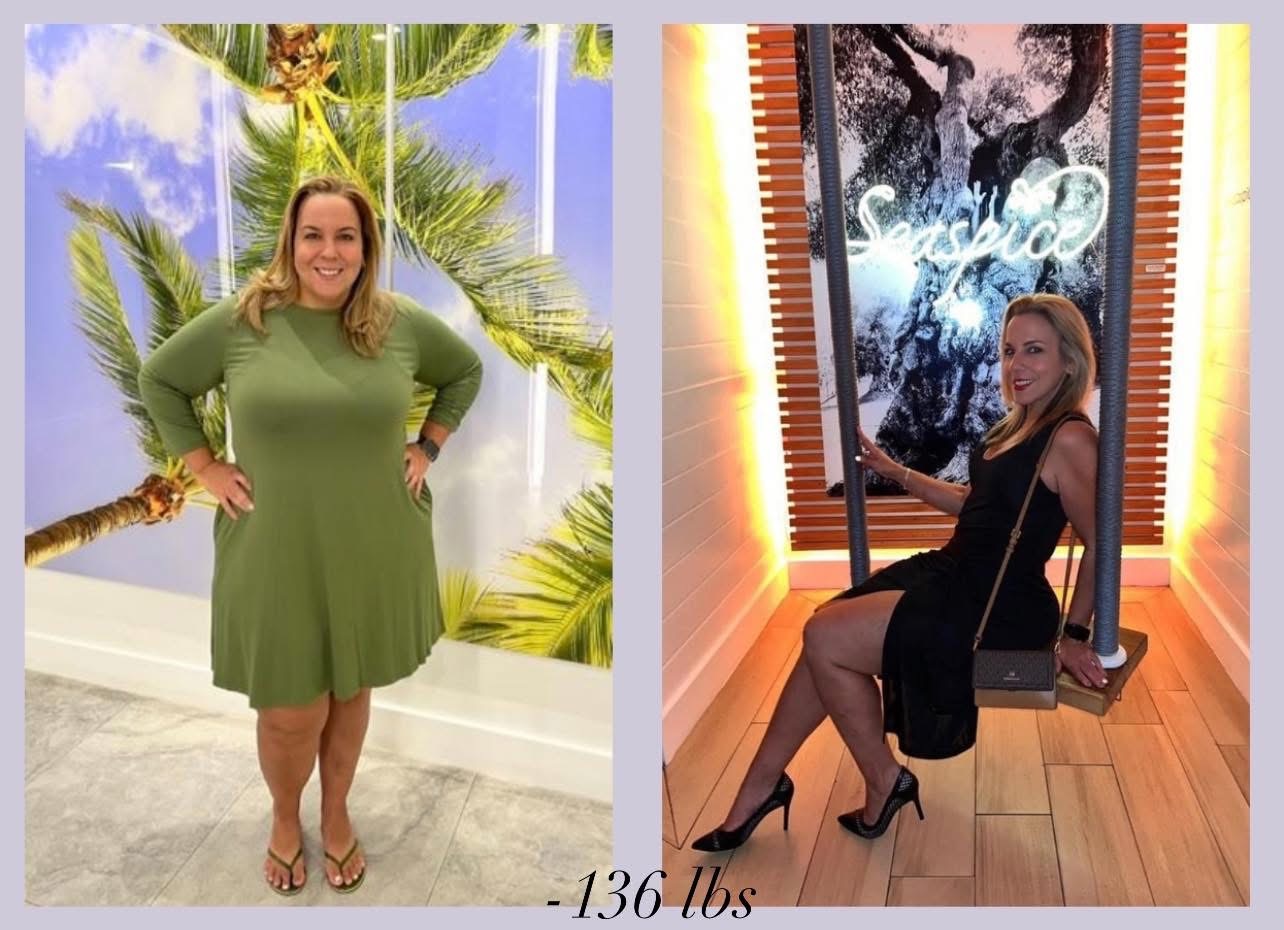 A photo showing Elizabeth before and after