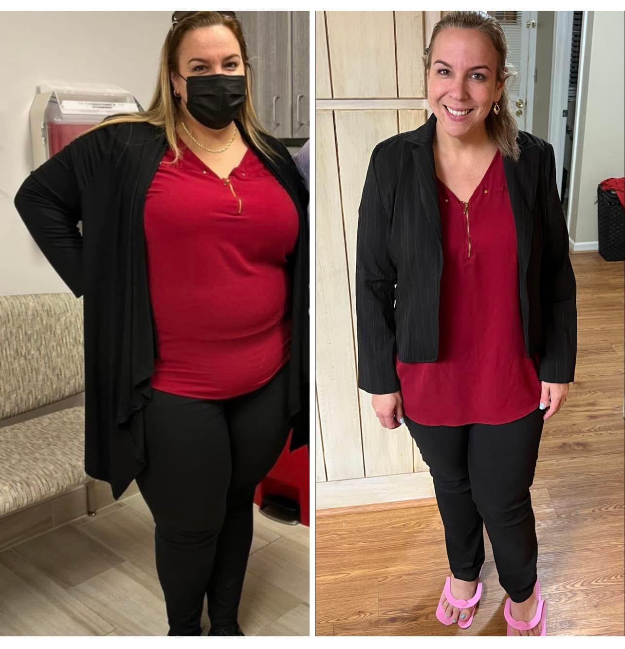 A photo showing Elizabeth before and after